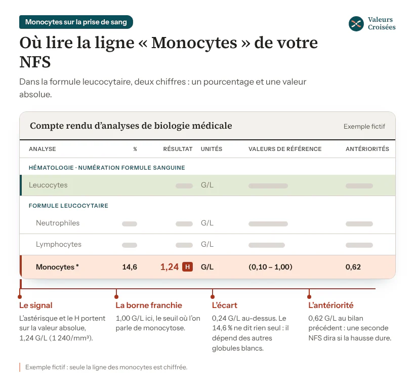 Extrait fictif de compte rendu de NFS, formule leucocytaire : la ligne Monocytes à 14,6 % et 1,24 G/L, signalée d’un astérisque et d’un H, pour des valeurs de référence de 0,10 à 1,00 G/L et 0,62 G/L au bilan précédent, sous les lignes leucocytes, neutrophiles et lymphocytes.